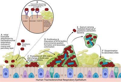 The Role of Non-Typeable Haemophilus influenzae Biofilms in Chronic Obstructive Pulmonary Disease